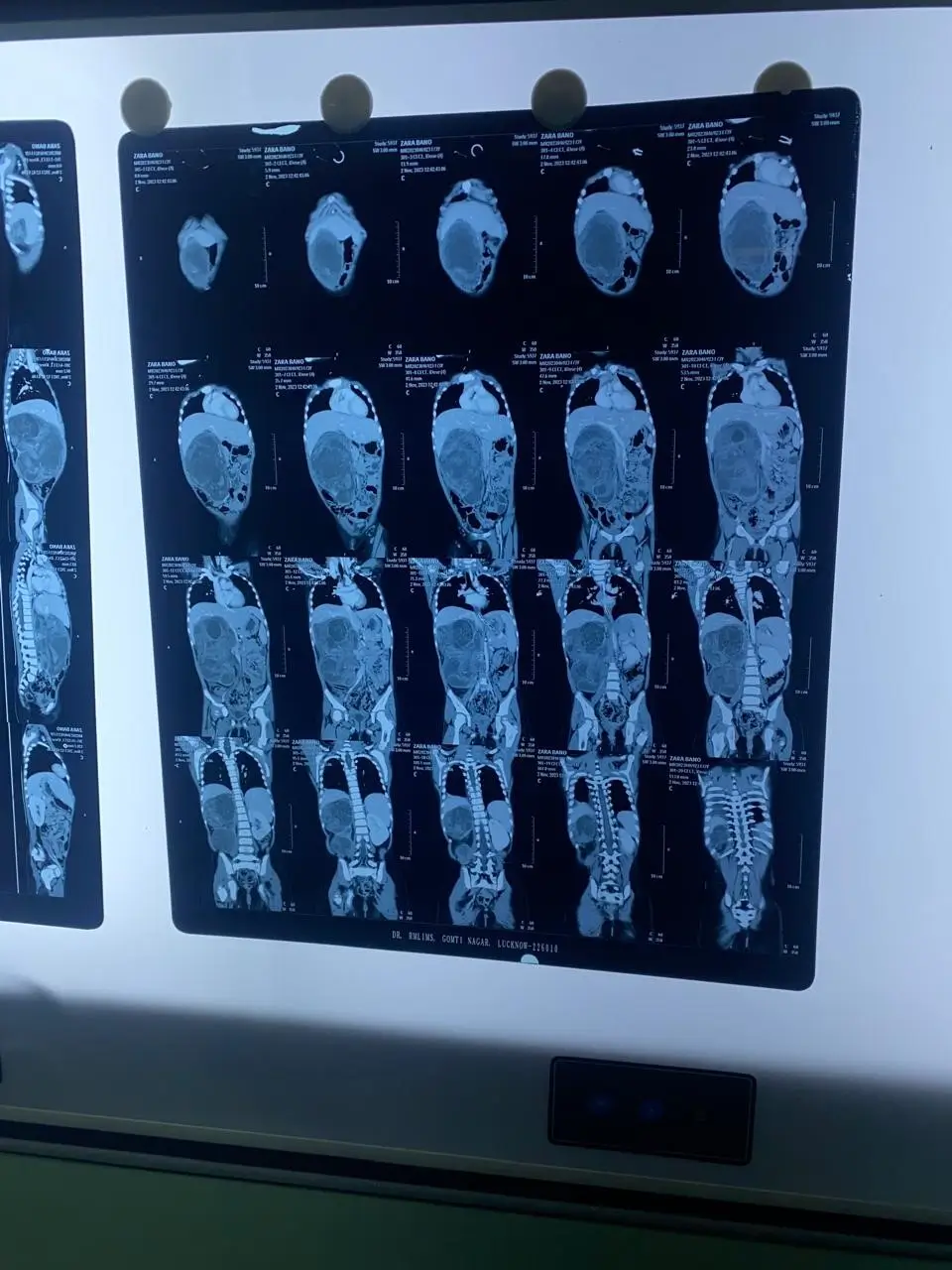 X-ray review