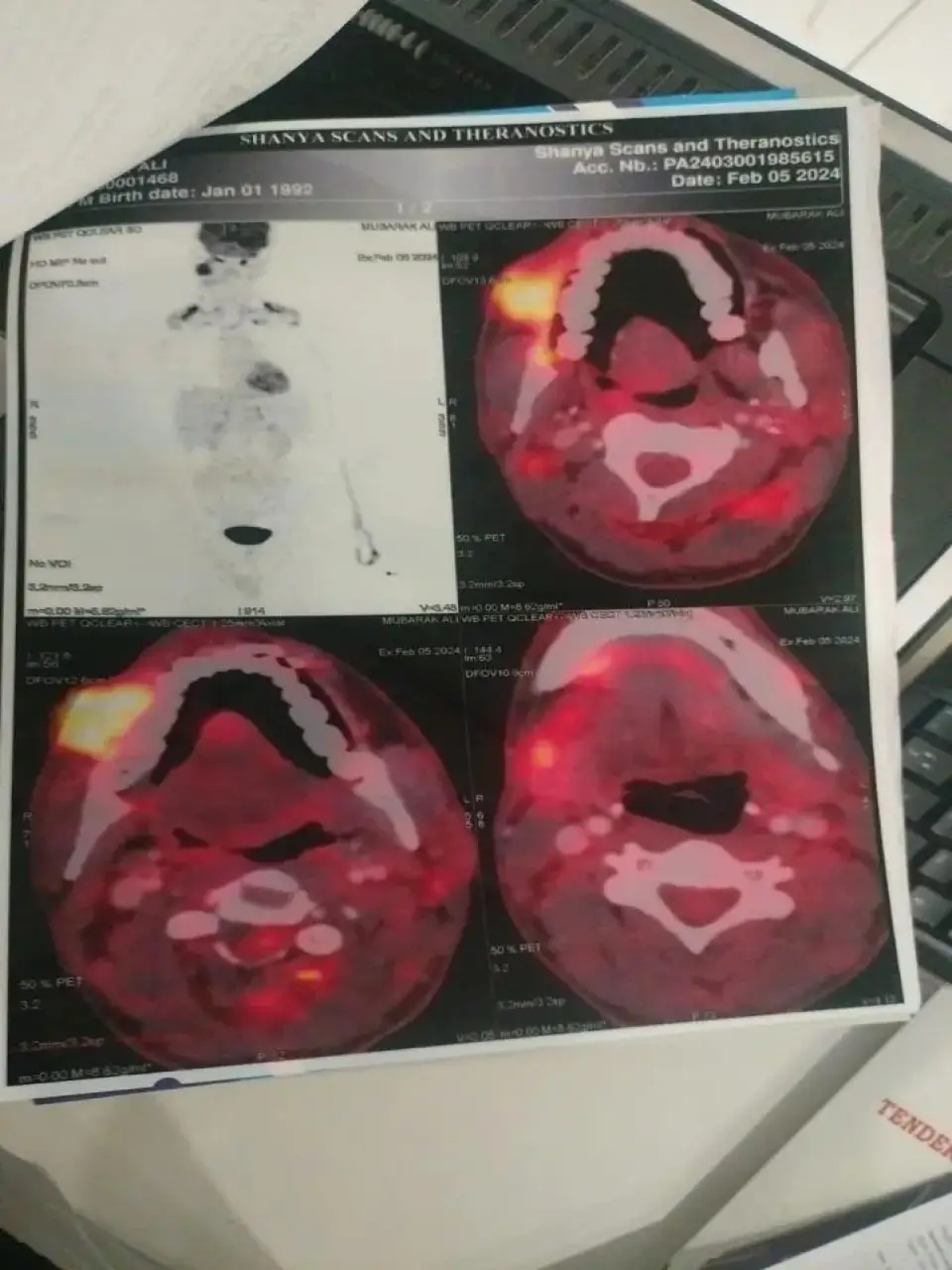 Scan imaging review